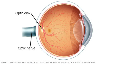 眼睛显示视神经和视盘